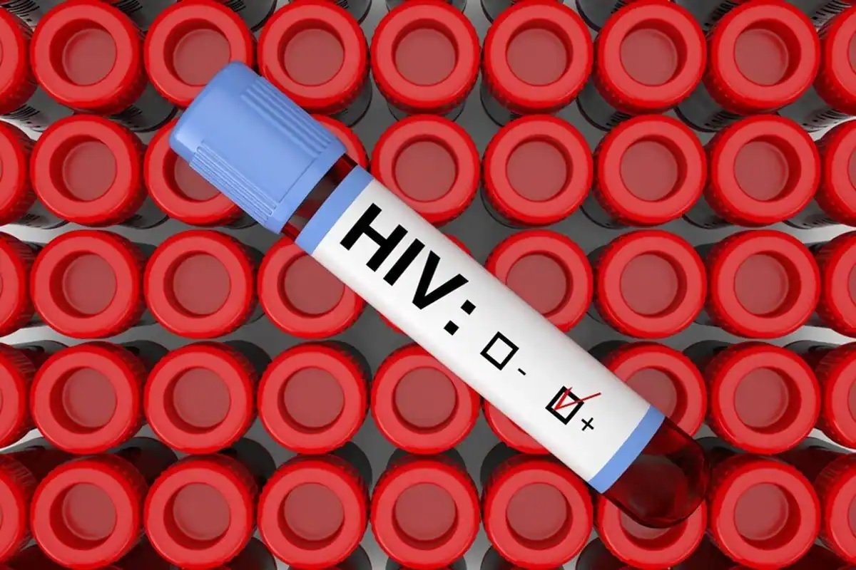 Tripura HIV Case: ત્રિપુરામાં HIVના કારણે 47 વિદ્યાર્થીઓના થયા મોત https://www.pravinews.com/world-news-in-gujarati/47-students-died-of-hiv-infection-828-tested-positive-in-tripura-17676