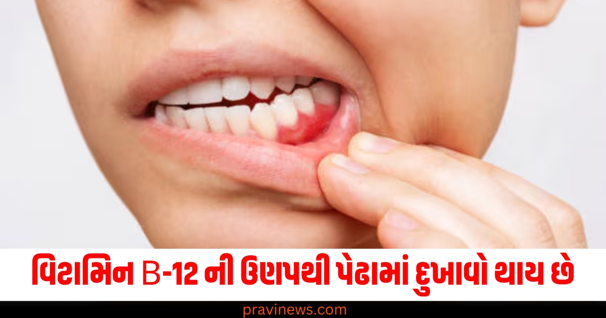 વિટામિન B-12 ની ઉણપથી પેઢામાં દુખાવો થાય છે, આ સંકેતોને ક્યારેય અવગણશો નહીં! https://www.pravinews.com/lifestyle/health-fitness/vitamin-b12-deficiency-symptoms-signs-precautions-sanket-lakshan-health-tips-toothache-gum-swelling-pain-59256