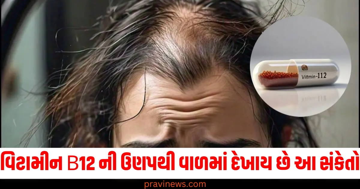 વિટામીન B12 ની ઉણપથી વાળમાં દેખાય છે આ સંકેતો, આ રોગોનો પણ હોઈ શકે છે ખતરો https://www.pravinews.com/world-news-in-gujarati/delhi-sanjeevani-yojana-eligibility-age-know-application-process-74044