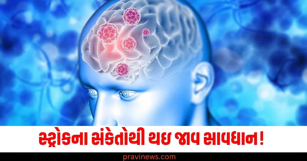 સ્ટ્રોકના સંકેતોથી થઇ જાવ સાવધાન! જાણો તેના પ્રકારો, કારણો, લક્ષણો અને નિવારણ. https://www.pravinews.com/lifestyle/brain-stroke-causes-reason-facts-symptoms-early-signs-sanket-lakshan-prevention-tips-health-77480