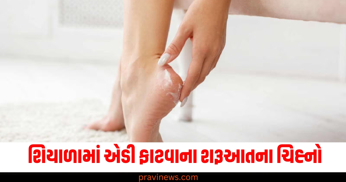 શિયાળામાં એડી ફાટવાના શરૂઆતના ચિહ્નો, આ છે તેનો ઈલાજ કરવાની સરળ રીતો https://www.pravinews.com