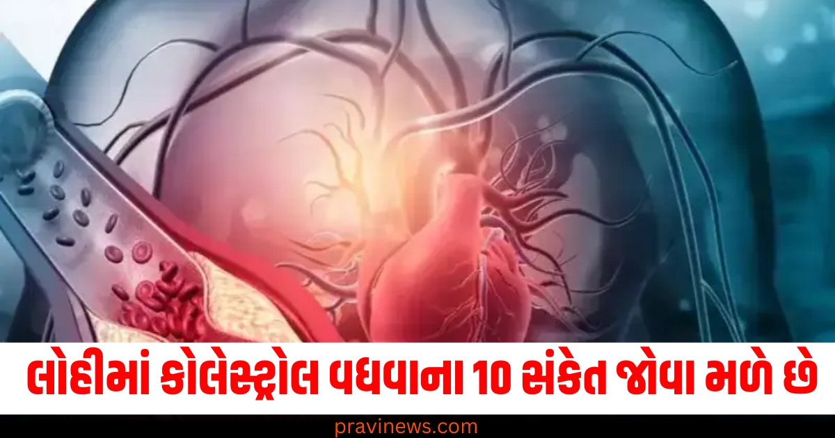 લોહીમાં કોલેસ્ટ્રોલ વધવાના 10 સંકેત જોવા મળે છે! આહાર નિષ્ણાતની આ સલાહ અનુસરો https://www.pravinews.com