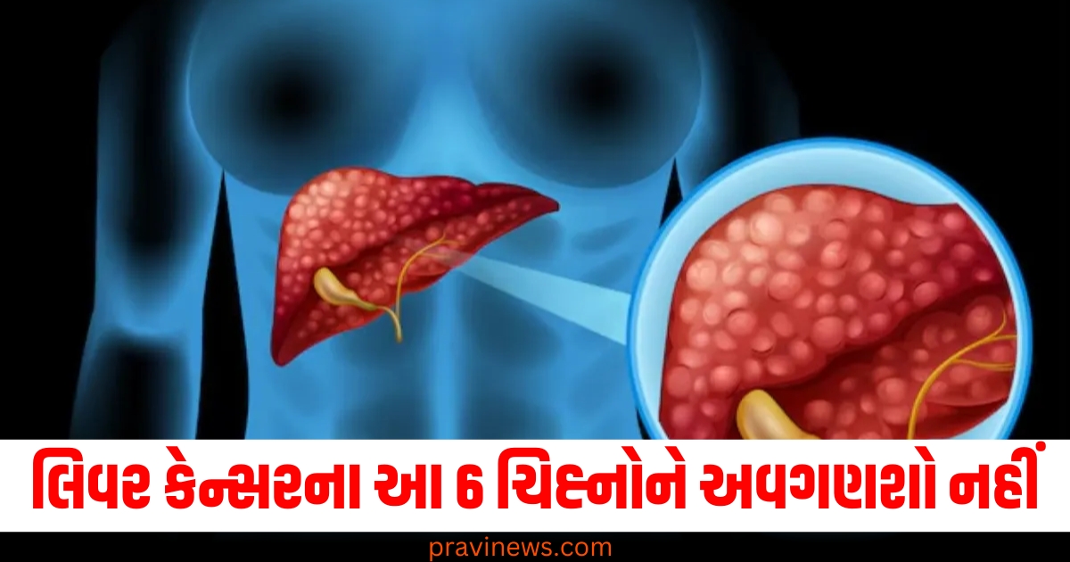 Liver cancer signs and symptoms, Signs of liver cancer to not ignore, Liver cancer early symptoms, How to recognize liver cancer, Liver cancer warning signs,