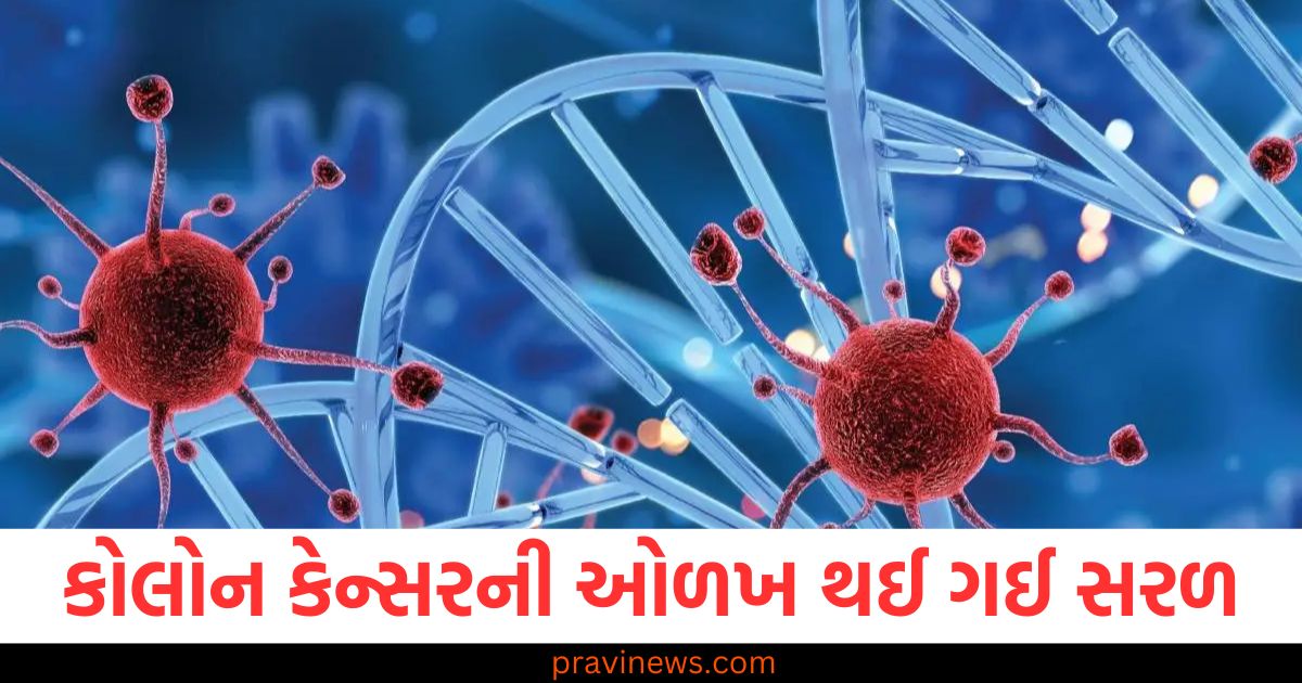 કોલોન કેન્સરની ઓળખ થઈ ગઈ સરળ, રોગના સંકેતો ફક્ત રક્ત પરીક્ષણ દ્વારા જ શોધી શકાશે https://www.pravinews.com